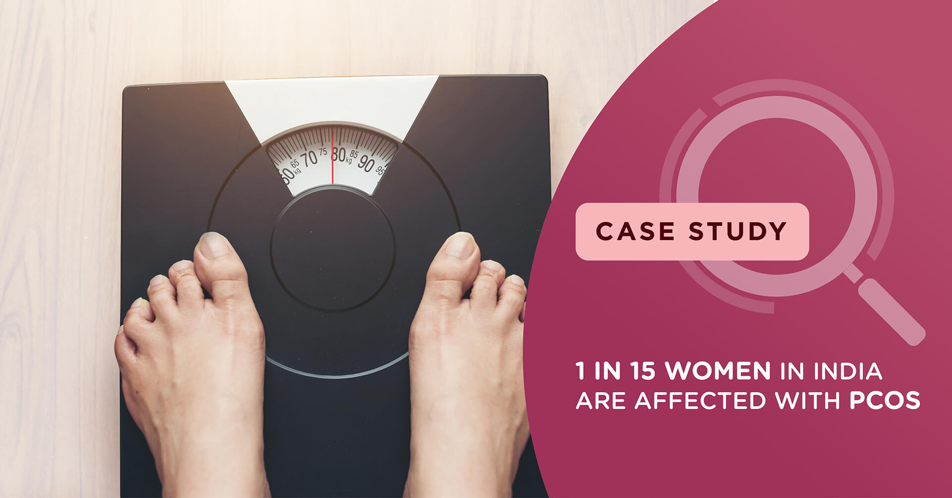 1 in 15 women in India are affected with PCOS: In many cases leading to infertility issues