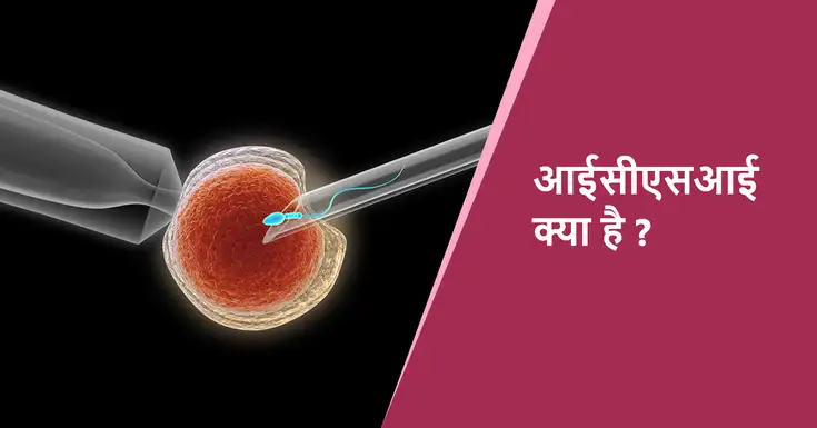  आईसीएसआई प्रक्रिया (ICSI Treatment in Hindi)