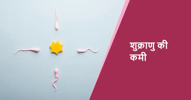  कम शुक्राणुओं की संख्या (Low Sperm Count in Hindi)
