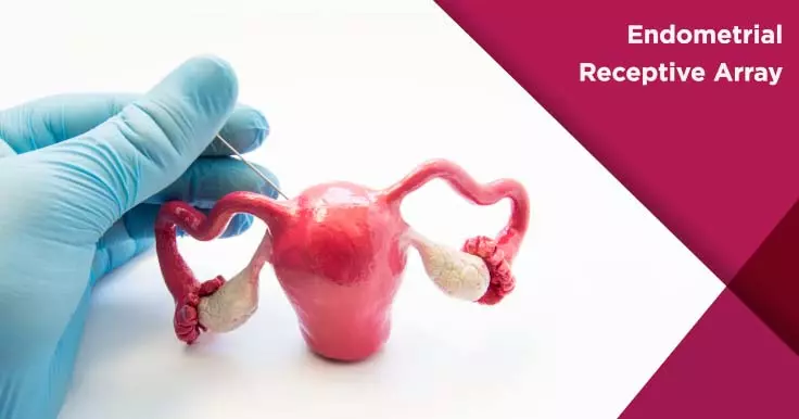 ERA Test: Assessing Uterine Receptivity for IVF Success