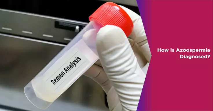 Azoospermia Diagnosis: Impact on Male Fertility