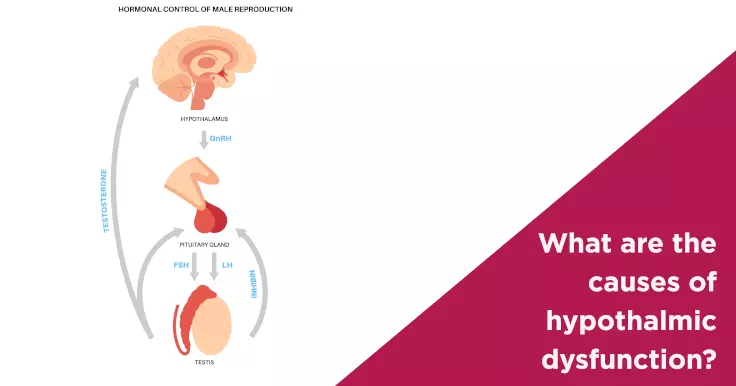  Causes of Hypothalamic Dysfunction: What You Should Know