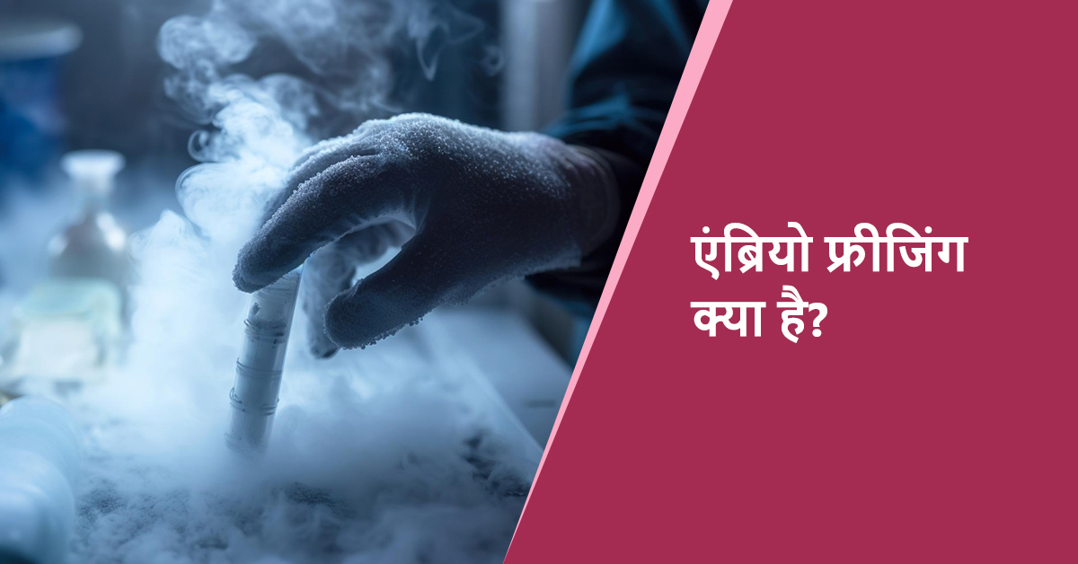 भ्रूण का जमना (एम्ब्रियो फ्रीजिंग)