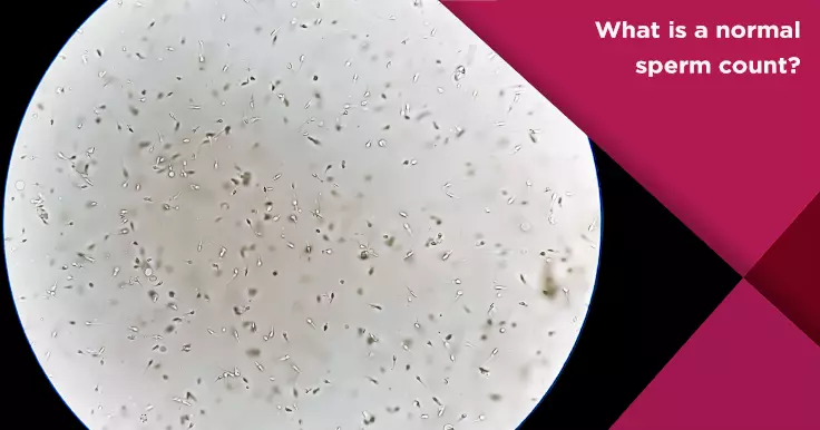 What is a Normal Sperm Count?